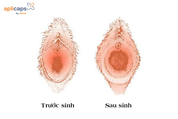 hinh-anh-am-dao-truoc-va-sau-sinh