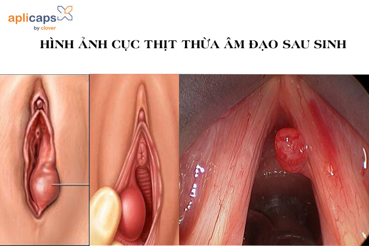 hinh-anh-cuc-thit-thua-o-vung-kin-sau-sinh