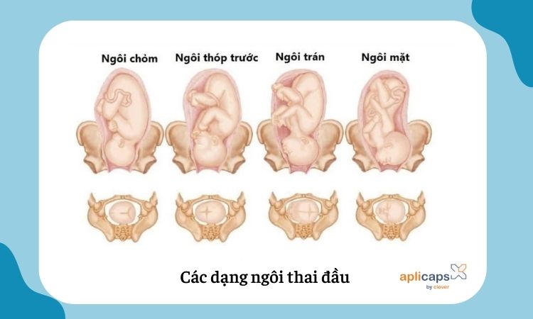 Hình ảnh thai nhi ngôi đầu