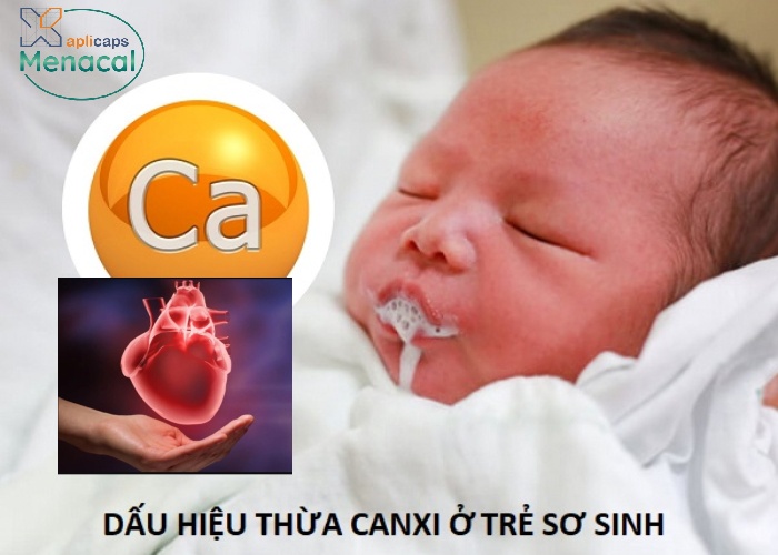 Bổ sung thừa canxi có thể gây ra các bệnh lý về tim mạch