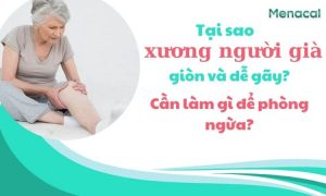 Tại sao xương người già giòn và dễ gãy