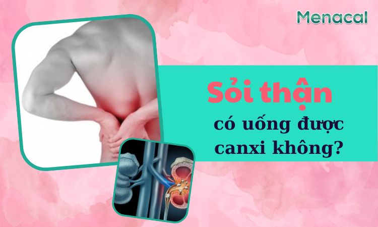 sỏi thận có uống được canxi không