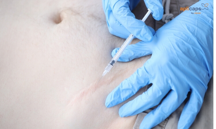 Tiêm corticosteroid là một phương pháp điều trị sẹo lồi hiệu quả
