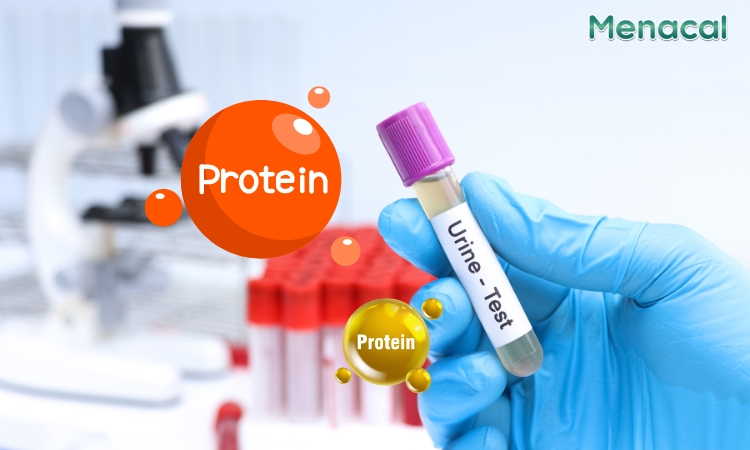 Protein niệu là một đặc điểm chẩn đoán tiền sản giật