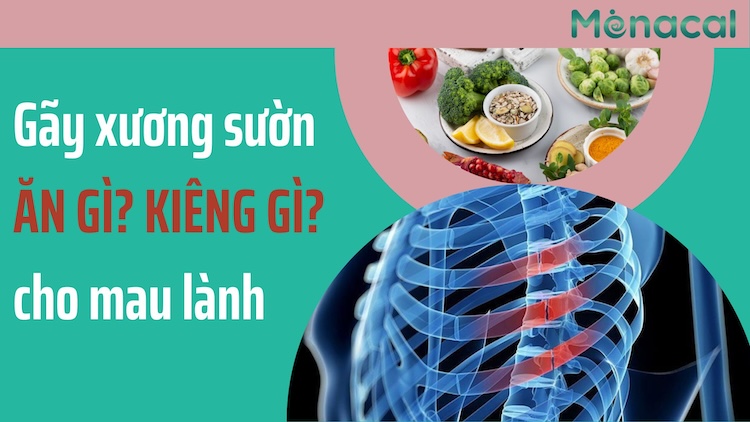 Phòng ngừa gãy xương sườn