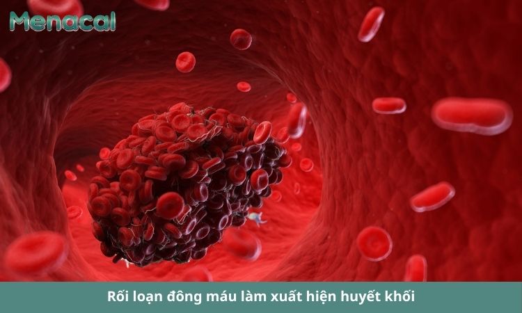 Huyết khối làm tắc nghẽn mạch máu và hỏng các cơ quan trong cơ thể