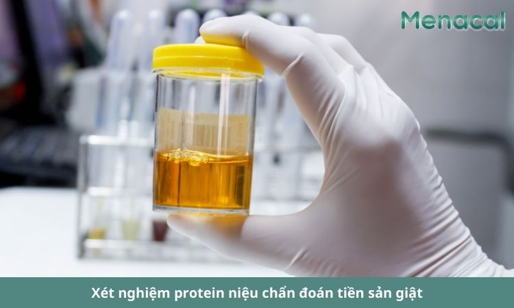 Xét nghiệm nước tiểu là phương pháp chẩn đoán tiền sản giật được đánh giá cao