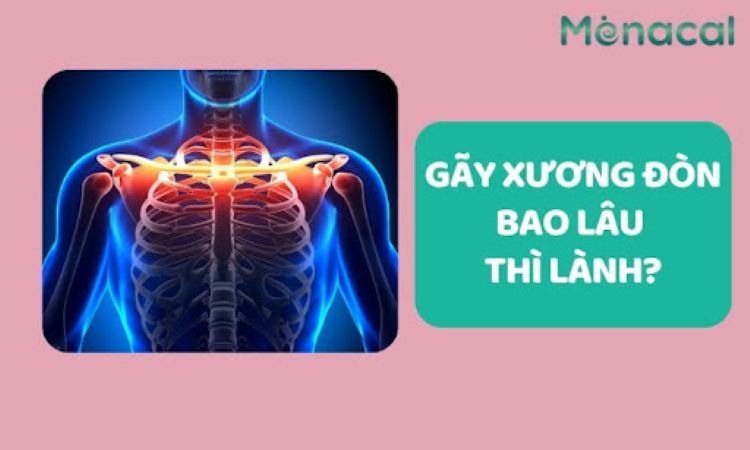 Gãy xương đòn bao lâu thì lành?