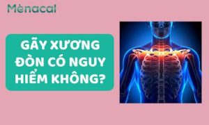 gãy xương đòn có nguy hiểm không?