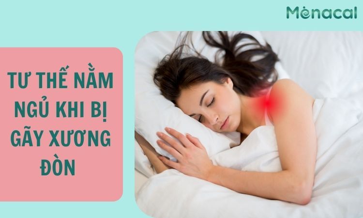 Tư thế ngủ khi bị gãy xương đòn