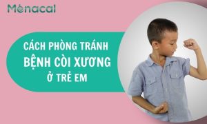 Nhận biết và cách phòng tránh bệnh còi xương ở trẻ