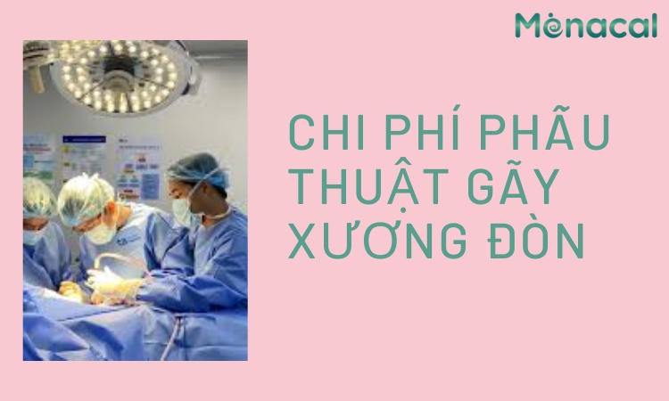 chi-phi-phau-thuat-gay-xuong-don