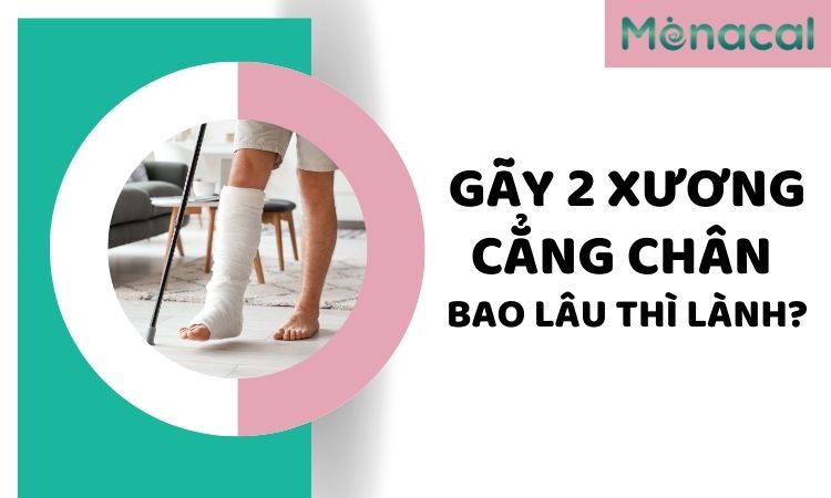 gãy 2 xương cẳng chân bao lâu thì lành