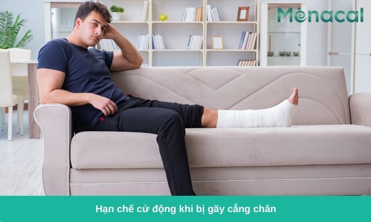 Bó bột là phương án thường được sử dụng khi bị gãy xương cẳng chân