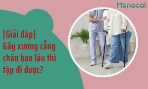 [Giải đáp] Gãy xương cẳng chân bao lâu thì tập đi được?