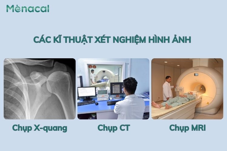 Các kĩ thuật xét nghiệm hình ảnh