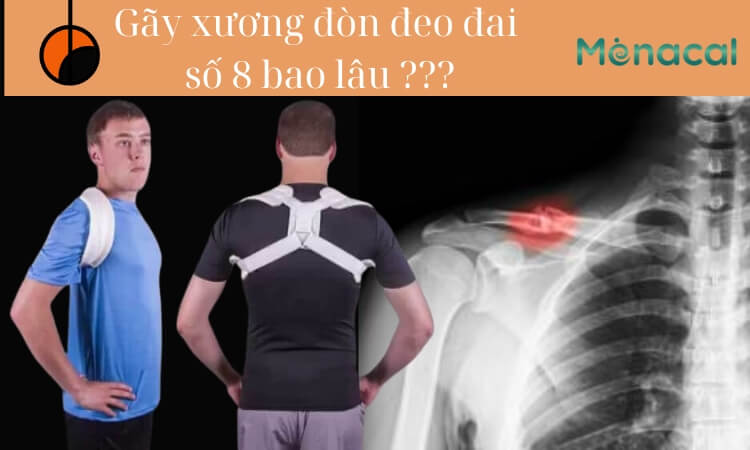 Gãy xương đòn đeo đai số 8 bao lâu? Hướng dẫn đeo đai số 8 đúng cách