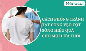 Cách phòng tránh tật cong vẹo cột sống