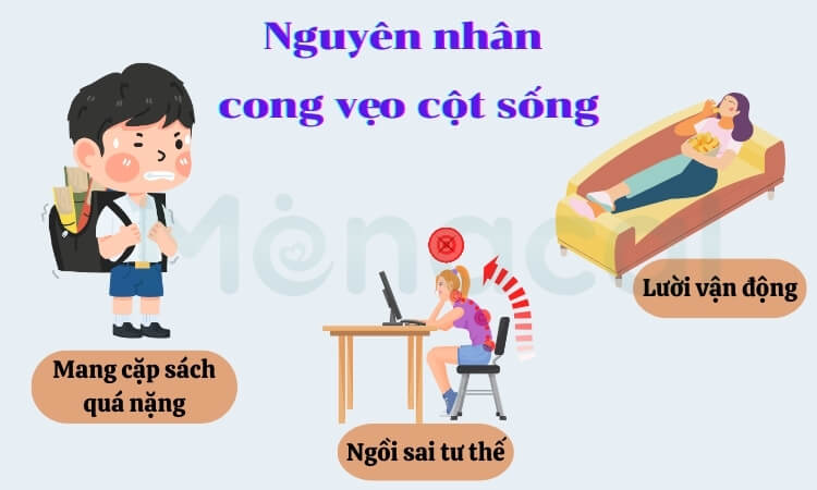 Một số nguyên nhân gây cong vẹo cột sống học đường