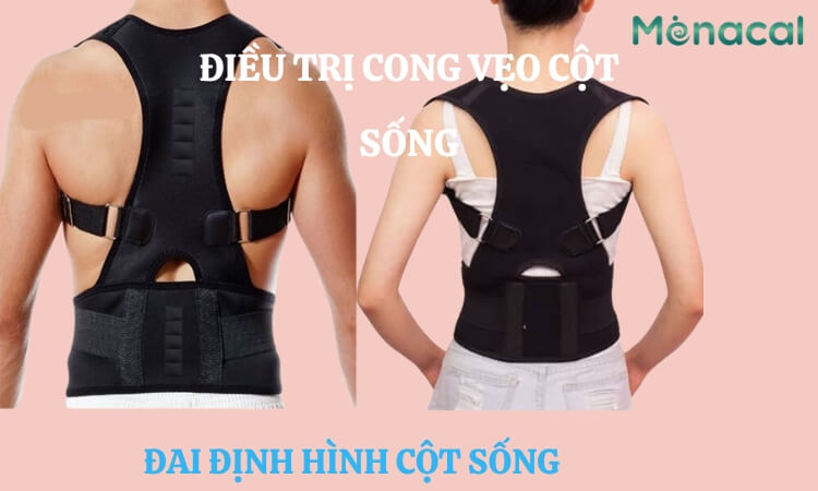 Đeo đai chỉnh hình điều trị cong vẹo cột sống