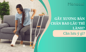 Gãy xương bàn chân bao lâu thì lành