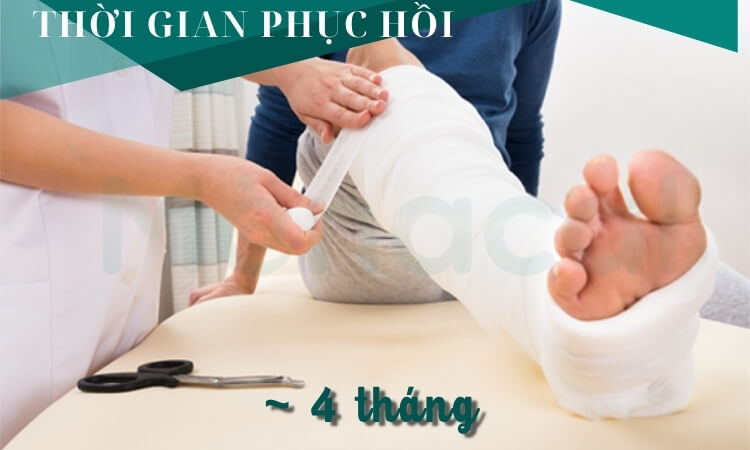 Thời gian phục hồi sau khi điều trị gãy xương chày