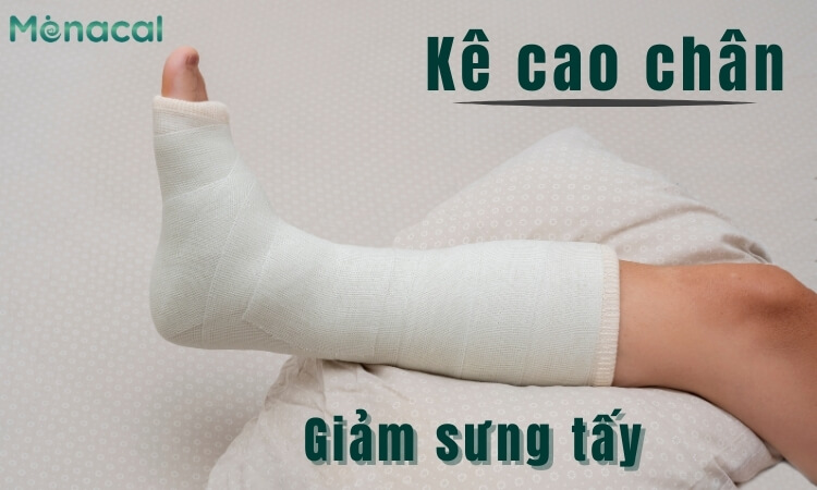 Khi nằm nên kê cao chân trong thời gian bó bột