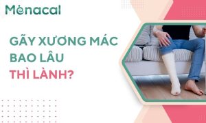 gãy xương mác bao lâu thì lành