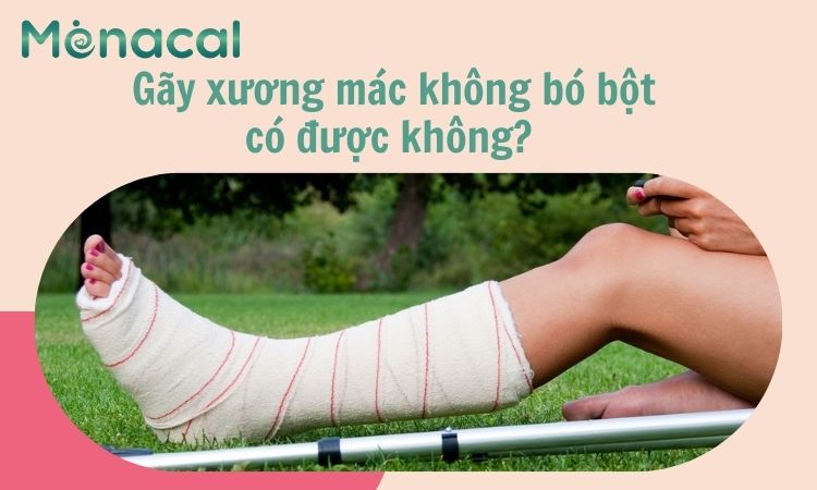 gãy xương mác không bó bột