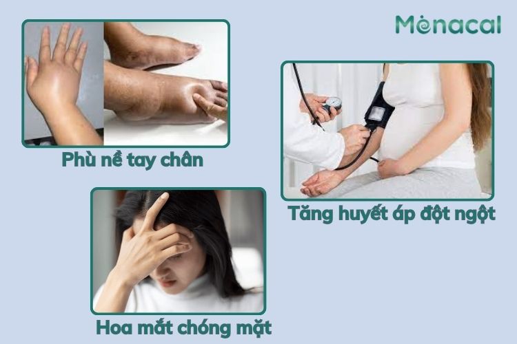 Một số dấu hiệu cần chú ý của tăng huyết áp thai kỳ