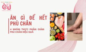 an-gi-de-het-phu-chan