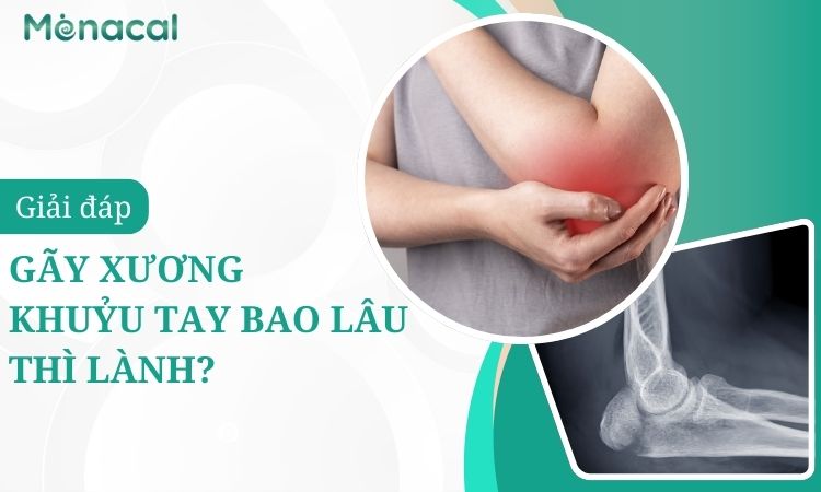 gãy xương khuỷu tay bao lâu thì lành