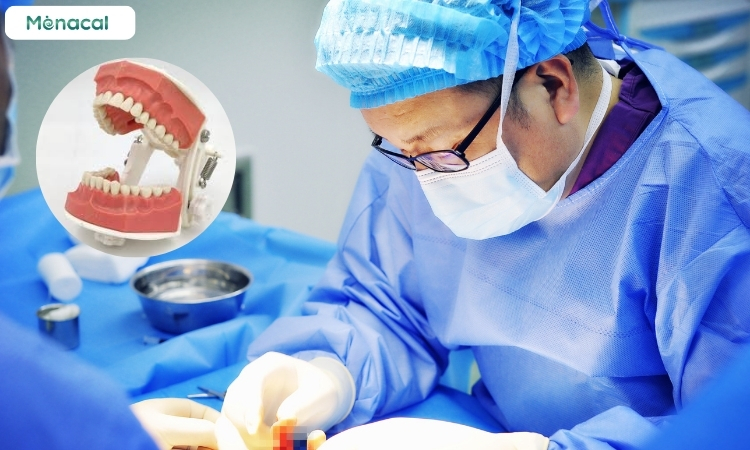 Phương pháp điều trị gãy xương hàm dưới - Bó hàm