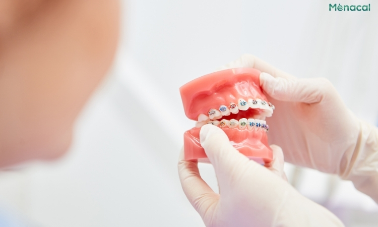 Sai khớp cắn có thể xảy ra nếu điều trị gãy xương hàm không đúng cách