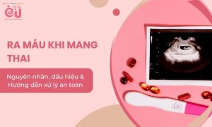 ra-mau-khi-mang-thai