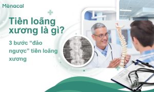 tien-loang-xuong-la-gi