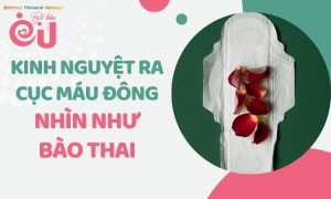 kinh-nguyet-ra-mau-dong-nhin-nhu-bao-thai