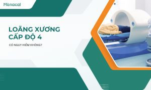 loang-xuong-cap-do-4