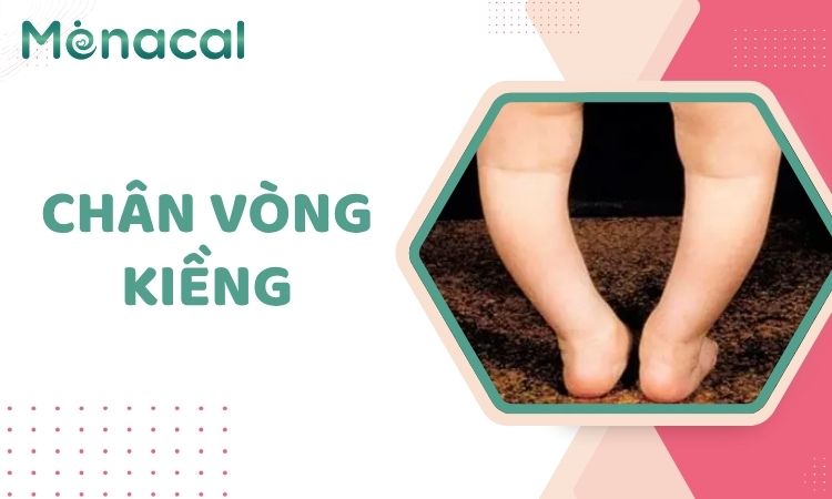 chan-vong-kieng (6)