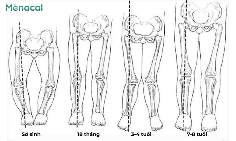 Các giai đoạn phát triển của chân trẻ em