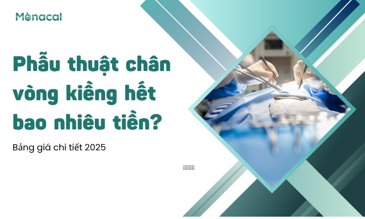 phau-thuat-chan-vong-kieng-het-bao-nhieu-tien