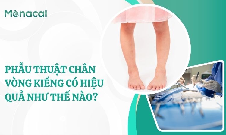 huẫ