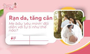 Mẹ bầu 'yêu mình' đối diện với tự ti như thế nào