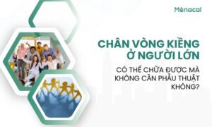 chân vòng kiềng ở người lớn có thể chữa được mà không cần phẫu thuật không